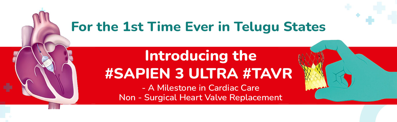 TAVR Treatment in Hyderabad