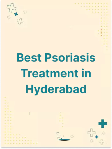 Best Psoriasis Doctor in Hyderabad