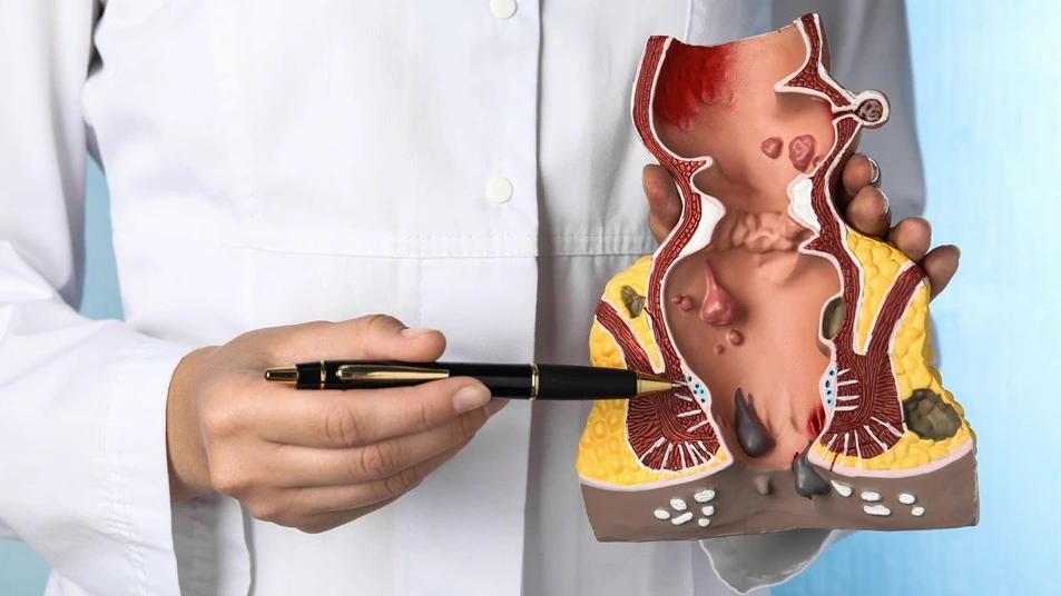 Best piles specialist near me